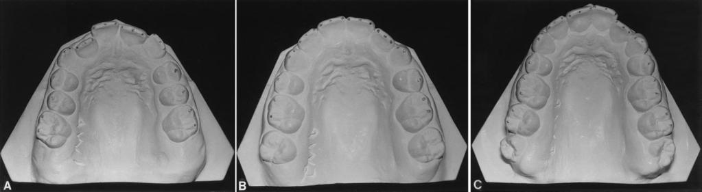 62 and 0.71, P 0.001). C and D, After treatment (T2) to T3 of two central incisors (r 0.47 and 0.49, P 0.001). Fig. 4.