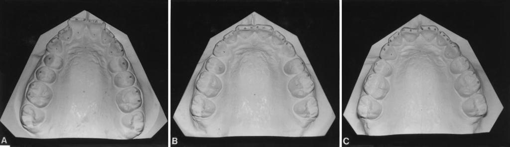 American Journal of Orthodontics and Dentofacial Orthopedics Volume 113, No. 2 Surbeck et al. 193 Fig. 5.