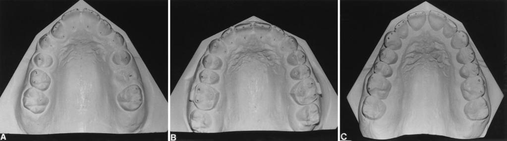 194 Surbeck et al. American Journal of Orthodontics and Dentofacial Orthopedics February 1998 Fig. 8.