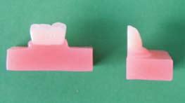 Artifical tooth and polymer-base bond in removable dentures... 193 C for the first 45 minutes and at 100 C for the next 45 minutes).