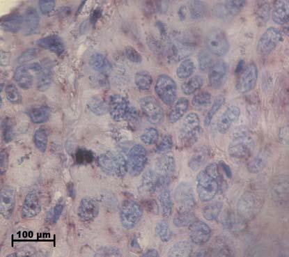 The section was counterstained with haematoxylin and detected using
