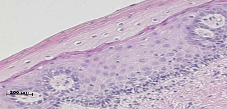 S I P B Figure 3.1: H&E of a normal epithelium.