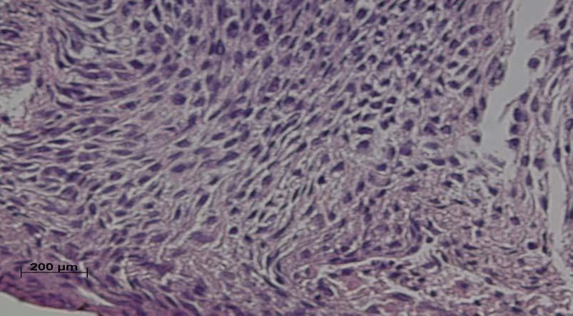 superficial (S). Haematoxylin and eosin staining of the ectocervix with magnification 400X. L SC S Figure 3.