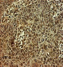 normal tissue section which has low expression values of the protein. Negative control was done to compare the background.