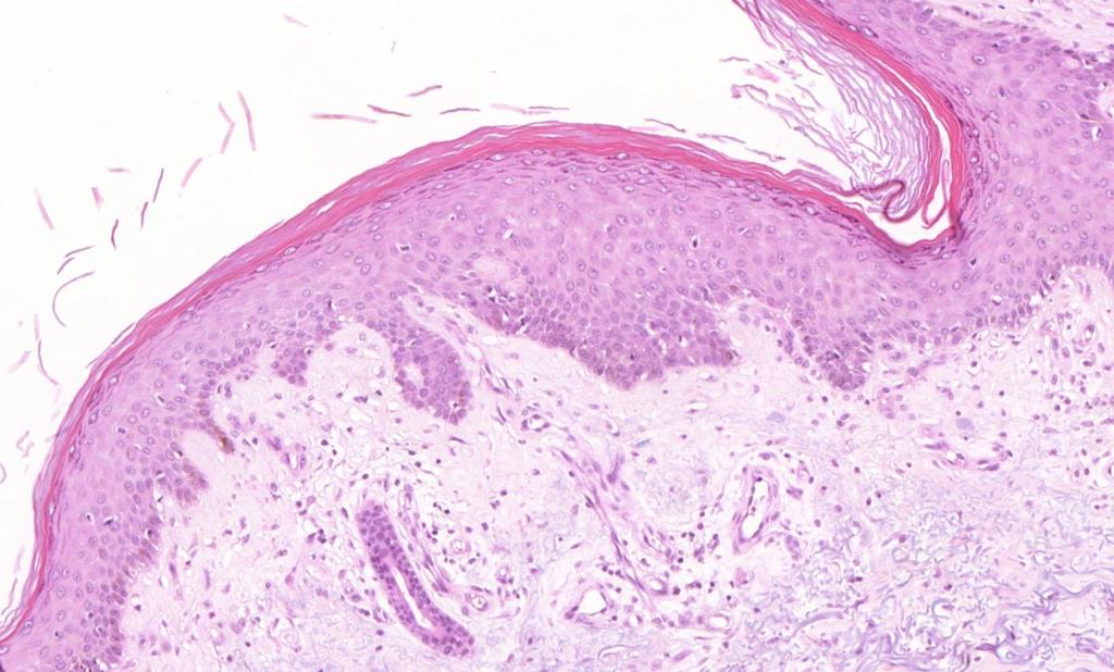 Histology of the skin Epidermis: Stratum corneum Stratum granulosum Stratum