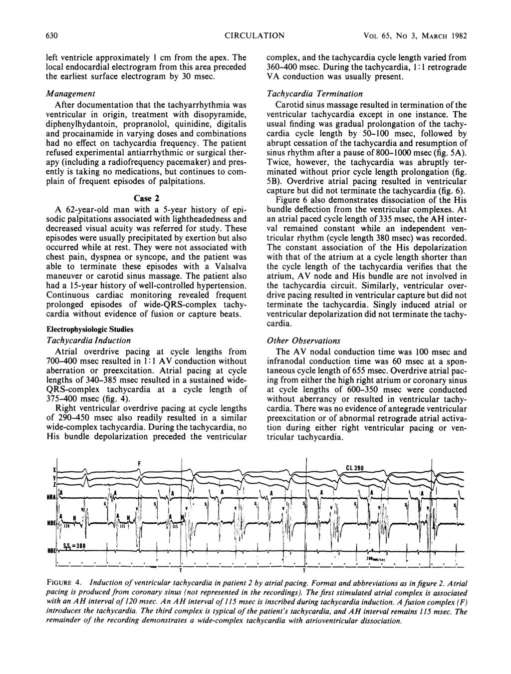 630 CIRCULATION VOL 65, No 3, MARCH 1982 left ventricle approximately 1 cm from the apex. The local endocardial electrogram from this area preceded the earliest surface electrogram by 30 msec.