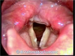 Laryngeal oedema obstructing the airway Cerebral oedema in