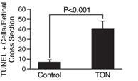 irreversible. Under stress or ischemia such as TON, the local tissue concentrations of adenosine are likely to increase due to the release of ATP and its conversion to adenosine by ectonucleotidases.