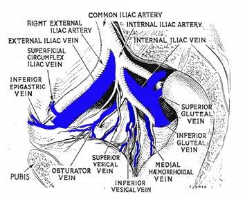 Conclusions 4 interconnected systems L renal vein 2 abdominal-pelvic reservoirs Ovarian veins The renal hilum Internal iliac veins The pelvis Symptoms related to Great reservoir saphenous distension