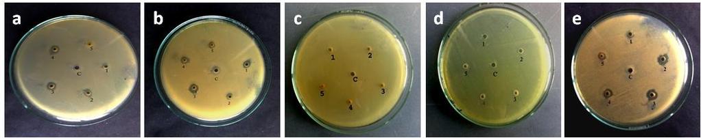 Determination of antibacterial activity of Nigella sativa L extract Antibacterial activities of crude extracts of N. Sativa seeds were evaluated by agar-well diffusion method.
