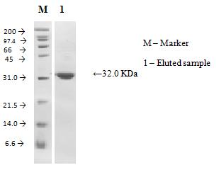 Figure 1 Elution profile of protease on Sephadex G-100 column of Cobia sample Elution profile of protease on Sephadex