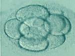 Cryopreservation Part 2: Embryo and Blastocyst Cryopreservation Blastocyst Freezing Embryo Freezing Similar to oocyte freezing, embryos and blastocysts are preserved at sub-zero temperatures.