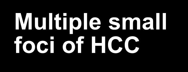 small foci of HCC