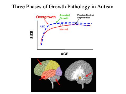 Genetic Conclusions The notion of finding a simple genetic cause to help define ASD will not likely occur.