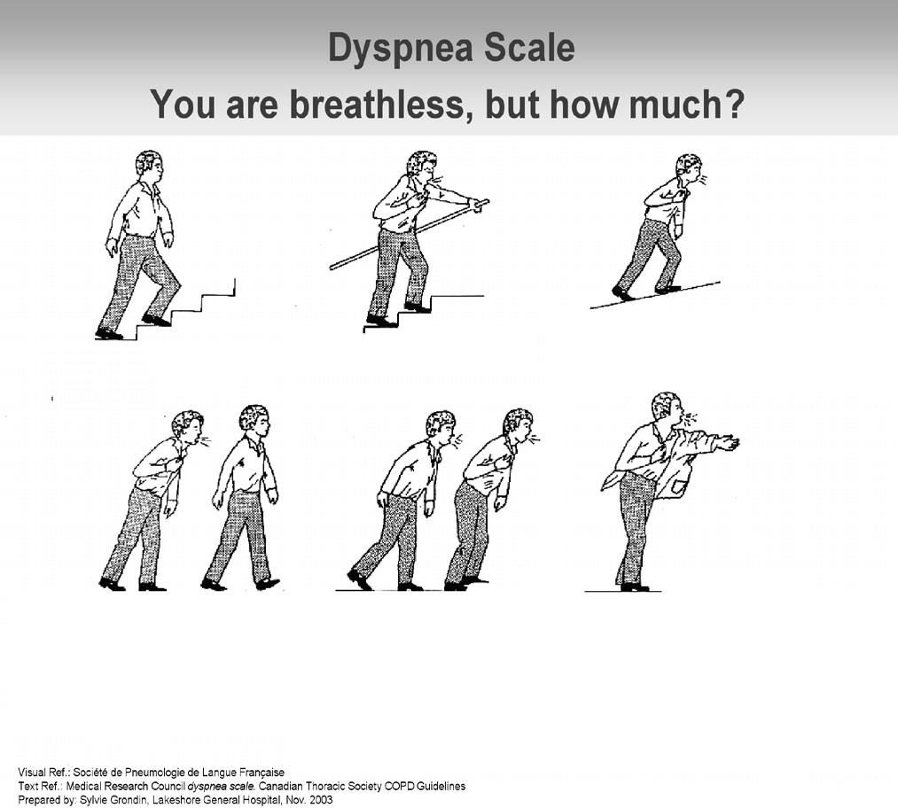 ATTACHMENTS Attachment 1 MRC Dyspnea Scale 0. No dyspnea. 1. Breathless with strenuous exercise. 2. Short of breath when hurrying on the level or walk up a slight hill. 3.