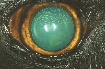 KERATIC PRECIPITATES Accumulated inflammatory debris on corneal