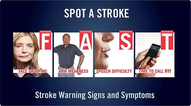 Warning Symptoms of Stroke Does one side of the face droop or is it numb? Ask the person to smile. Is the person's smile uneven?