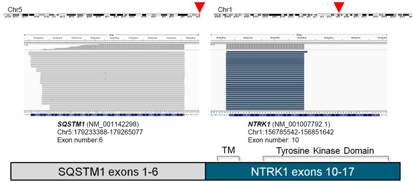 chemotherapy AMP detected NTRK1 fusion