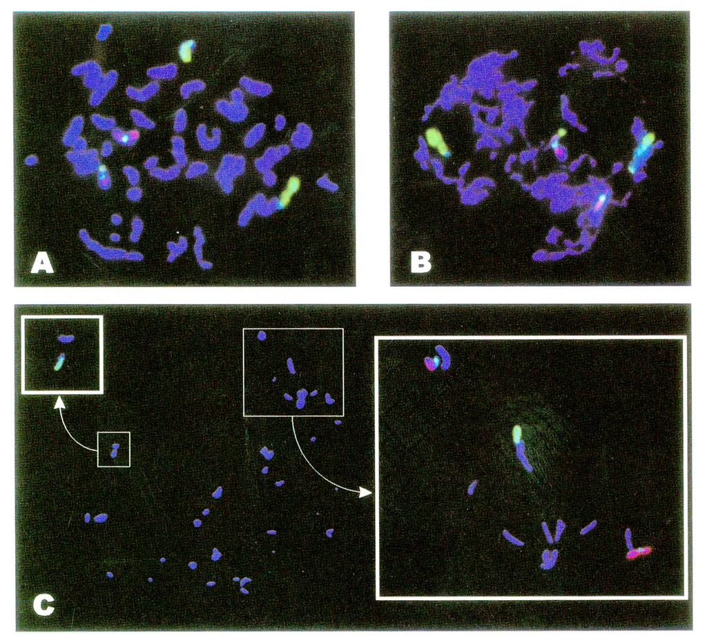 SHORT COMMUNICATION 135 Fig. 2. Three metaphases obtained from a single eight-cell embryo, carrier of unbalanced, maternally derived chromosomal translocation. Whole chromosome painting (WCP).