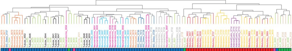 Special types of breast cancer are homogeneous at the transcriptome level