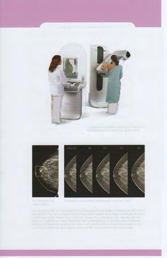 SELENIA DIMENSIONS The Selenia Dimensions systems is designed to maximize patient comfort during the exam.