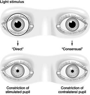 Clinical signification Under normal conditions, the pupils of both eyes respond identically to a light stimulus, regardless of which eye is being stimulated.