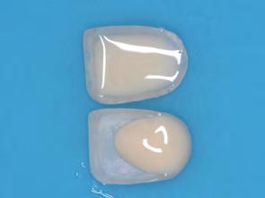 veneers Wetting reduces surface traction and helps