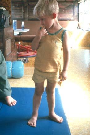 Distribution Of Weight In Standing Postural alignment in children with movement and posture disorganization is often asymmetrical and due to