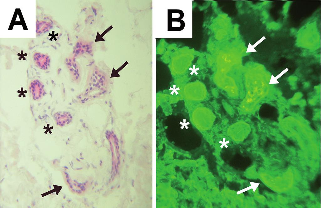 6 I. Sinem Bağcı et al. Fig.. Anti-8 and anti- staining of bullous pemphigoid sections.