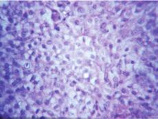 histochemical staining for enzymes like alkaline phosphatase, phosphorylase, succinic dehydrogenase, indoxyl esterase, and acid phosphatase was not available; they were not performed. 3.