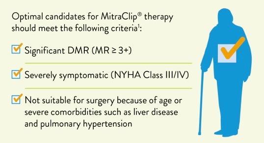 HEART TEAM DECIDES IF OPTIMAL FOR MITRACLIP A Heart Team will determine final MitraClip eligibility, assess surgical risk, and verify that