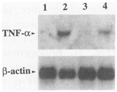 Adipose expression of TNF- : Neutralization of TNF-alpha in obese fa/fa rats caused a significant increase in the peripheral uptake of glucose in response to insulin
