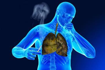 exertion - Persistent Chronic cough Wheezing/chest tightness Chronic