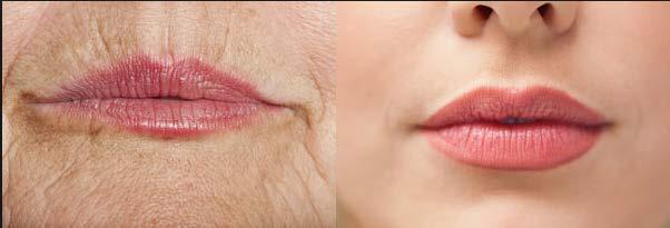 SOFT TISSUES 1- Lips: consists basically of muscles and minor