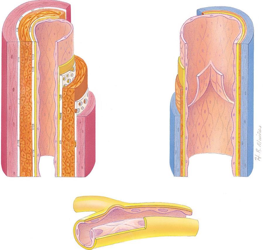 Arteries vs. Veins Each have the 3 layers. The middle layer of an artery shows more smooth muscle.