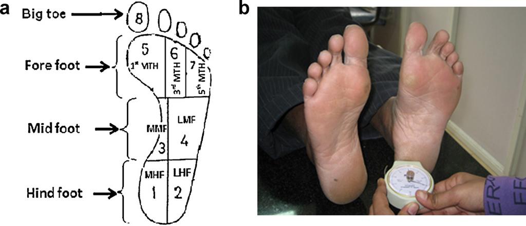 R. Periyasamy et al. / The Foot 22 (2012) 95 99 97 Fig. 1. (a) Division of foot and (b) hardness of foot sole assessed by Shore meter. Fig. 2. Repeatability tests hardness of foot sole measurement using Shore meter.