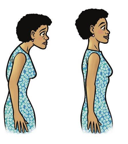 Practicing Good Posture Posture is the way you hold your body. Poor posture can keep muscles from properly supporting the neck.