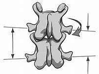 4. Coupling: means the vertebra bends and rotates together a. Type 1 motion = coupled to opposite side: ie. Side bend L, rotate R b. Type 2 motion = coupled to same side: ie. Side bend L, rotate L c.
