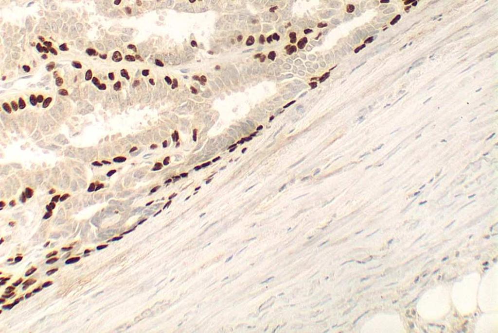 myoepithelial cells and MEC