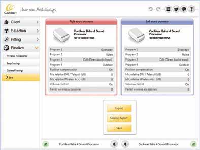 Saving the Programming Session Saving Your Session In this task you can review settings, save fitting session settings to the sound processor, to NOAH or