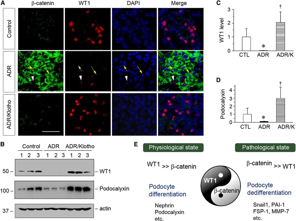 in a mutually exclusive manner in vivo. We further examined the expression of WT1 and its downstream podocalyxin by Western blotting.