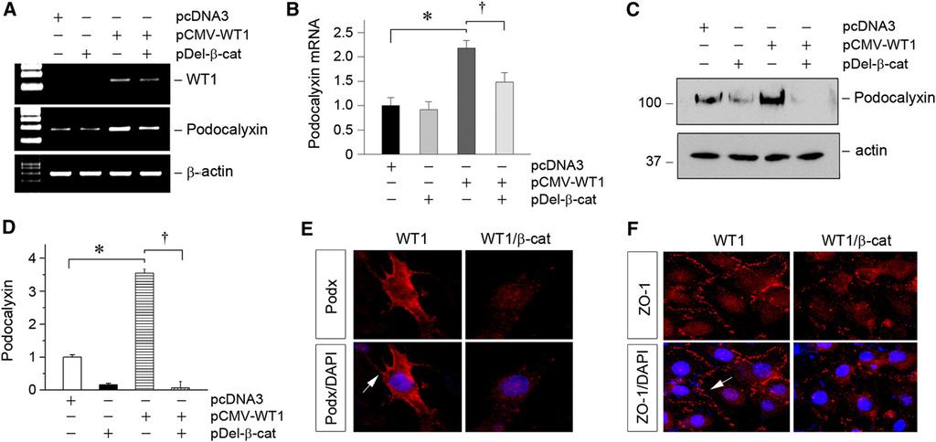 b-catenin Represses WT1-Mediated Gene Expression and Induces Podocyte Dedifferentiation Given that b-catenin induces WT1 protein degradation, we next tested whether b-catenin signaling suppresses