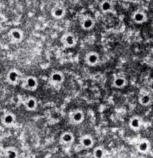 Innate Immune Molecules: Complement System Recognize pathogens antibodies lectins