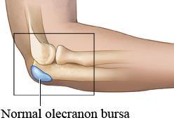 Ligaments and Bursae Ulnar collateral ligament Prevents