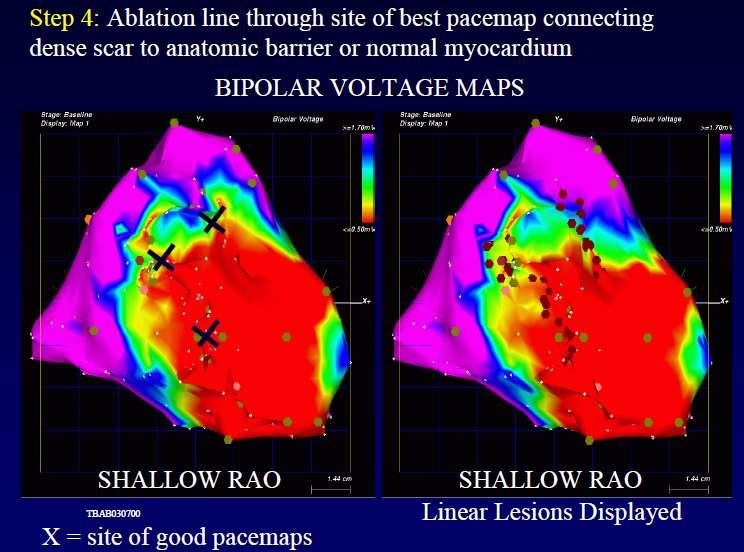VOLTAGE MAP AND