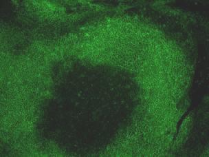 B cell marker B220 on frozen section of mouse spleen,