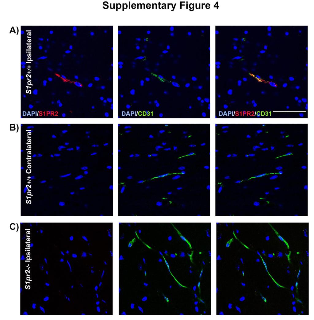 Supplementary Figure 4. S1PR2 immunofluorescence in ischemic striatum.