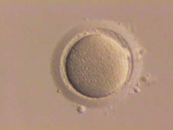 Options Females Embryo Cryopreservation Oocyte Cryopreservation Ovarian Shielding Ovarian Transposition GnRH Agonist Ovarian