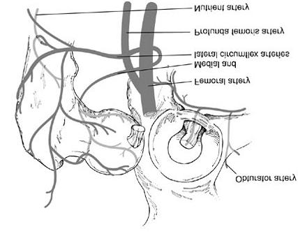 Página 4 de 6 and gemelli muscles. In 85% of people the nerve is a singular structure located in the normal position.