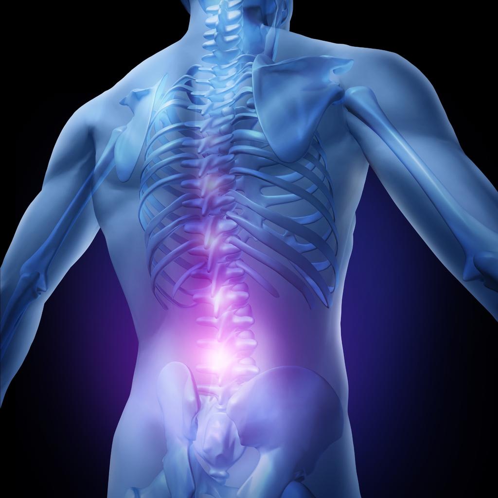 YOUR COMPLETE GUIDE TO FAILED BACK SURGERY